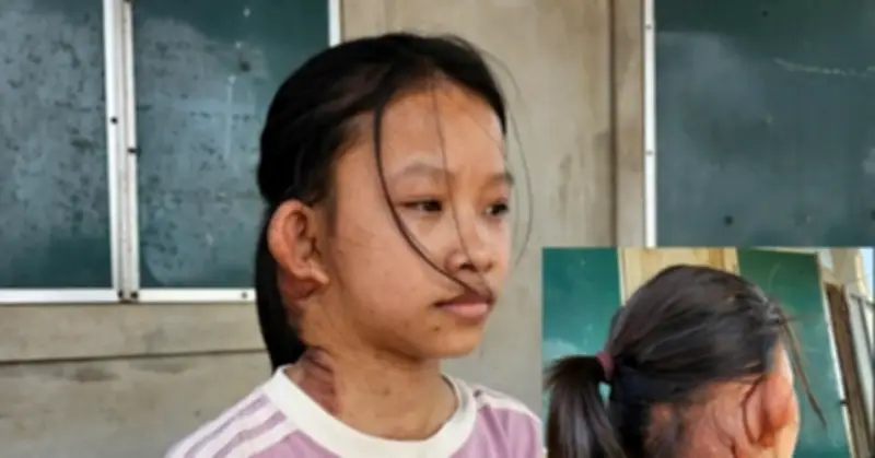 Ông Bà Nghèo Kiệt Quê Trước Ca Mổ Lần 3 Của Cháu Ngoại, Không Biết Vay Ở Đâu