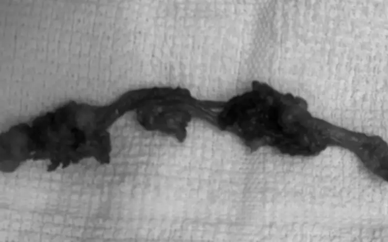 Đồng Nai: Phẫu thuật thành công ca nang niệu rốn hiếm gặp, bác sĩ cảnh báo biến chứng nguy hiểm