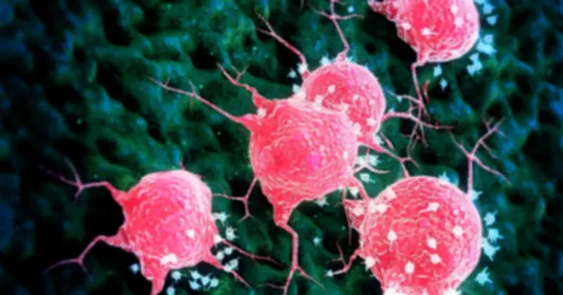 Nghiên Cứu Mới: Béo Phì Liên Quan Đến Nhiều Loại Ung Thư Hơn Dự Kiến, Giảm Cân Là Biện Pháp Phòng Ngừa Mạnh Mẽ