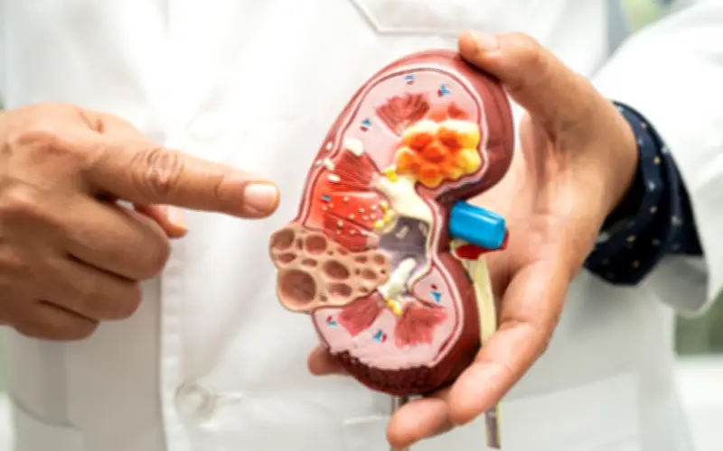 Người bệnh suy thận nên ăn hành nhánh thế nào để tốt nhất cho sức khỏe?