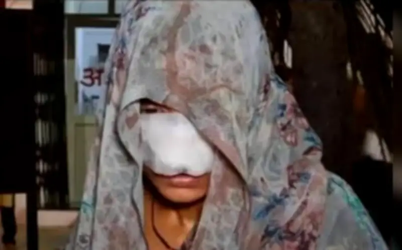 Người chồng ở Ấn Độ cắn rách mặt vợ trong cuộc cãi vã gia đình dữ dội