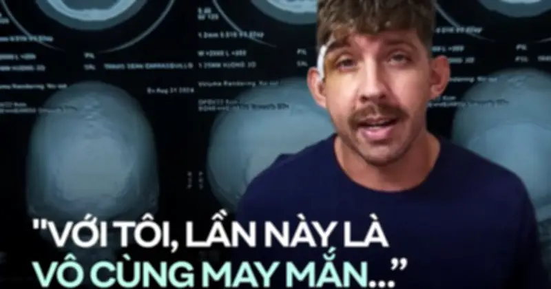 Người Mỹ ở Hawaii trải nghiệm khám chữa gãy xương tại bệnh viện công Đà Nẵng