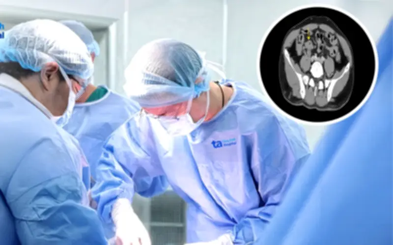 Người đàn ông 39 tuổi phát hiện ung thư đại tràng di căn gan từ dấu hiệu nhiều người bỏ qua