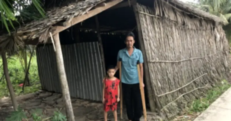 Người đàn ông nghèo mắc bệnh hoại tử chỏm xương đùi cần giúp đỡ