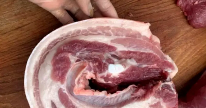 Nguy kịch từ thói quen chế biến thịt sống: Cảnh báo từ các ca bệnh thực tế