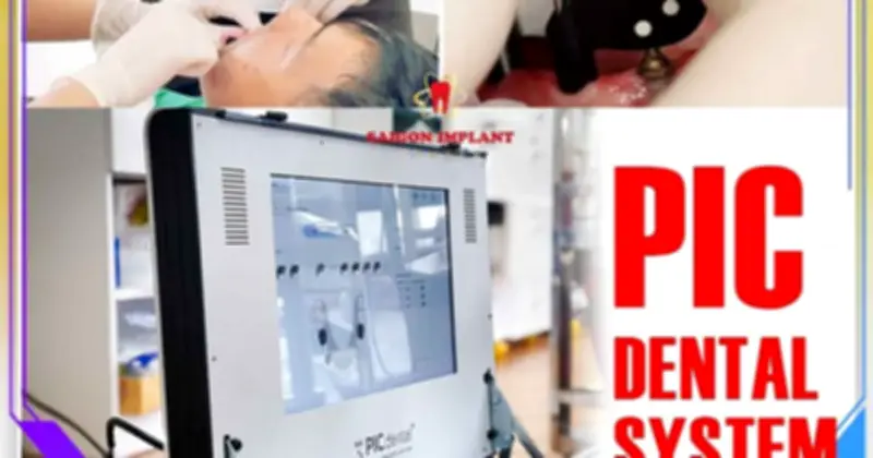 Nha khoa Saigon Implant định hình chuẩn mới với công nghệ PIC Dental và Face Scan 3D
