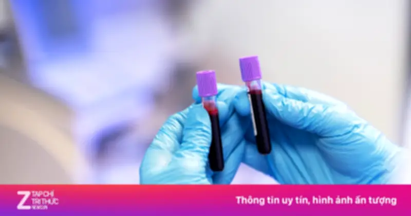 Nhóm Máu Có Thể Ảnh Hưởng Đến Nguy Cơ Mắc Bệnh Tim Mạch, Tiểu Đường Và Ung Thư
