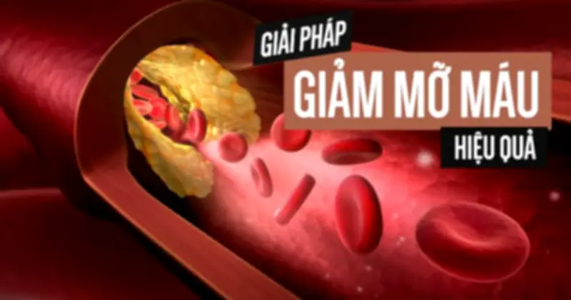 Những thực phẩm vàng hỗ trợ kiểm soát mỡ máu cao hiệu quả