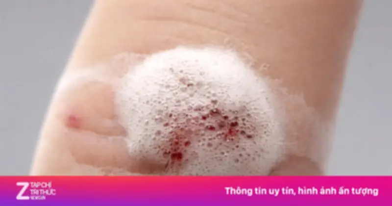 Oxy Già Hết Thời: Từ 'Thần Dược' Tủ Thuốc Đến Cảnh Báo Nguy Hiểm