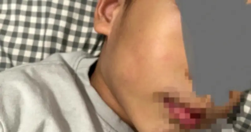 Phụ huynh tố cáo giáo viên đánh trẻ 4 tuổi ở TP.HCM, nhà trường đình chỉ công tác