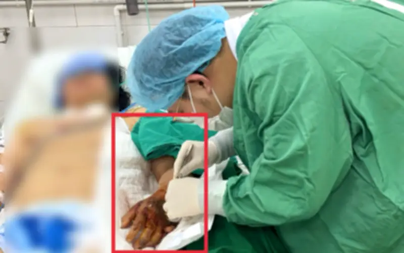 Phụ nữ 52 tuổi ở Bắc Ninh sốc nhiễm khuẩn từ vết thương nhỏ nhiều người bỏ qua