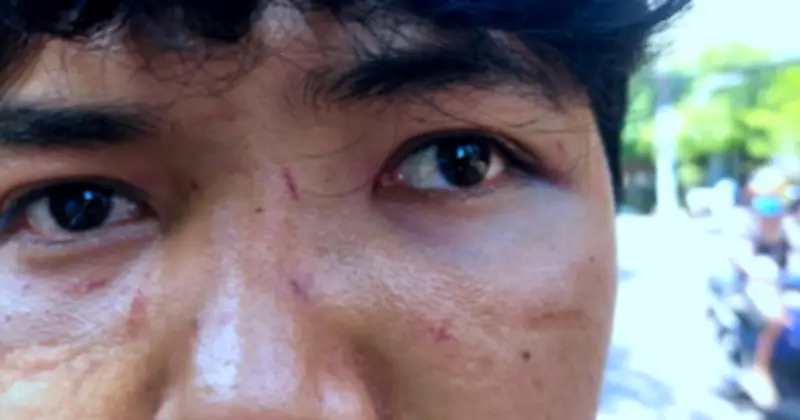 Phẫn nộ vụ hành hung cụ bà bán bánh bèo ở Quy Nhơn: Con trai can ngăn cũng bị đánh