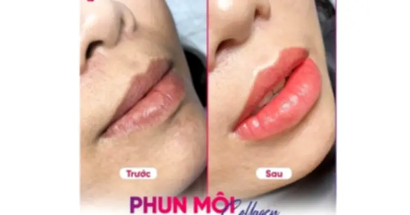 Seoul Center: Điểm đến phun môi lý tưởng với kỹ thuật chuyên nghiệp và an toàn