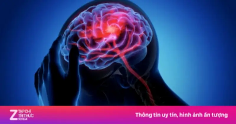 Đột Quỵ: Mỗi Phút Mất 2 Triệu Tế Bào Não Và Cuộc Chạy Đua Với Thời Gian