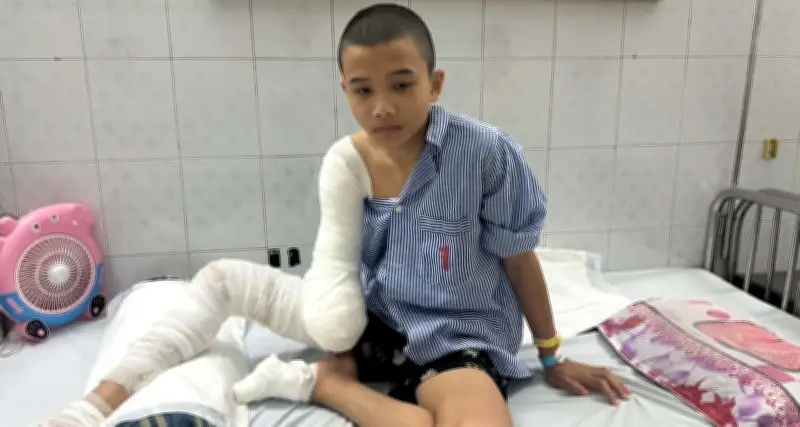 Tai nạn điện cao thế cướp 1/3 cánh tay phải, tương lai cậu bé 16 tuổi chênh vênh