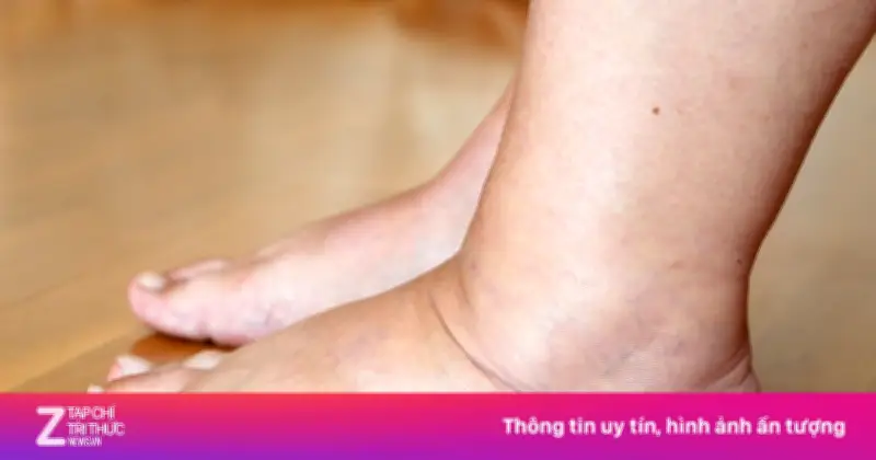 Thói Quen Hại Gan Nhanh Không Kém Rượu Bia: Cảnh Báo Từ Lối Sống Hiện Đại