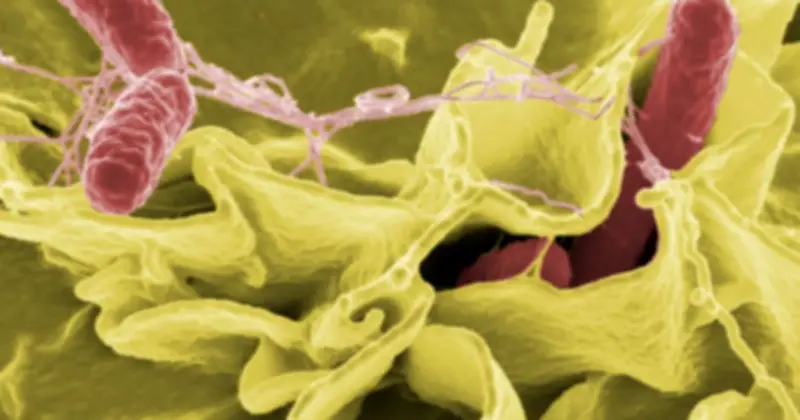 TP HCM: 190 ca nghi ngộ độc tại trường tiểu học, phát hiện vi khuẩn Salmonella