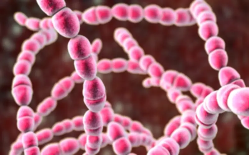 Trẻ 11 tuổi nguy kịch do viêm cầu thận cấp hậu nhiễm liên cầu khuẩn