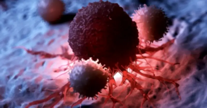 Ung thư giai đoạn sớm: Nhận diện dấu hiệu âm thầm để phát hiện kịp thời