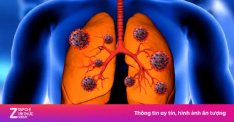 Ung thư phổi gia tăng tại Việt Nam: Nhóm nguy cơ cao cần tầm soát sớm