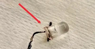 Bác sĩ gắp thành công bóng đèn LED trong phế quản bé 9 tháng tuổi