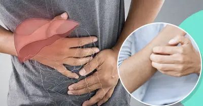 Gan 'im lặng' cảnh báo qua ngứa da, vàng mắt: Dấu hiệu không thể bỏ qua