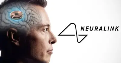 Neuralink của Elon Musk: Từ 'cơn sốt' con trỏ đến cuộc đua chuyển hướng sang công nghệ ngôn ngữ