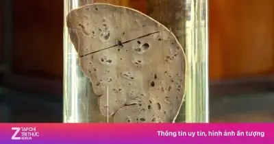 Thói quen ăn rau sống, gỏi cá: 'Sát thủ' âm thầm hủy hoại gan