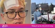 Ca sĩ Hàn Woodie Gochild kể lại tai nạn rơi từ tầng 3, suýt mất mạng