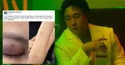 Công An TP.HCM Xác Minh Tố Cáo Ca Sĩ Trung Quân Hành Hung Bác Sĩ