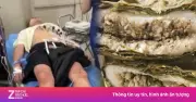 Cảnh báo nguy hiểm từ trào lưu ăn bánh trứng kiến, một thanh niên cấp cứu nửa đêm