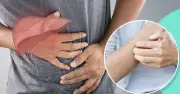 Gan 'im lặng' cảnh báo qua ngứa da, vàng mắt: Dấu hiệu không thể bỏ qua