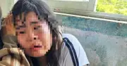 Nữ sinh lớp 7 bị đánh nhập viện ở Quảng Ngãi, nhà trường báo công an xử lý