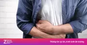 Áp Xe Gan Do Ký Sinh Trùng: Biểu Hiện, Nguy Cơ Và Cách Phòng Ngừa Hiệu Quả