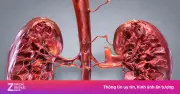 Sai lầm ăn uống âm thầm tàn phá thận: Bồi bổ sai cách khiến bệnh tiến triển nhanh