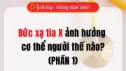 Tia X ảnh hưởng thế nào đến cơ thể người? Phân tích chi tiết từ chuyên gia