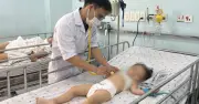 TP.HCM: Dịch tay chân miệng bùng phát mạnh, số ca nặng tăng gấp 5 lần