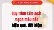 Video: Quy trình tầm soát mạch máu nào hiệu quả, tiết kiệm?