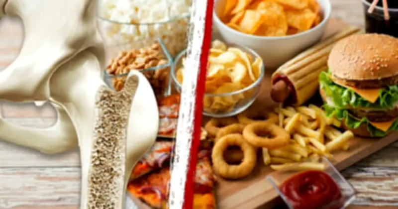 5 nhóm thực phẩm người bị loãng xương cần tránh xa