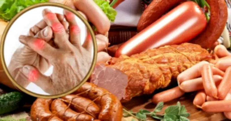 6 loại thực phẩm càng ăn nhiều càng gây đau khớp, viêm khớp