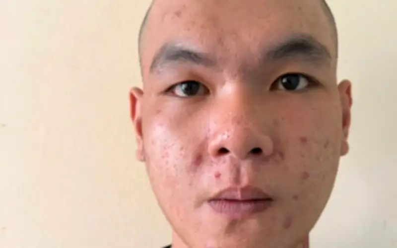 An Giang: Con trai trộm xe máy của cha bán lấy tiền tiêu xài