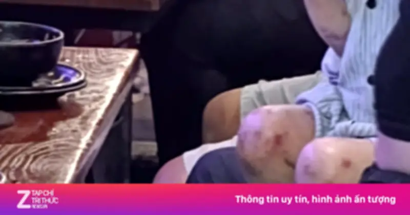 Bé gái 3 tuổi nghi bị bạo hành tại quán bia: Công an xác định không có dấu hiệu bạo lực