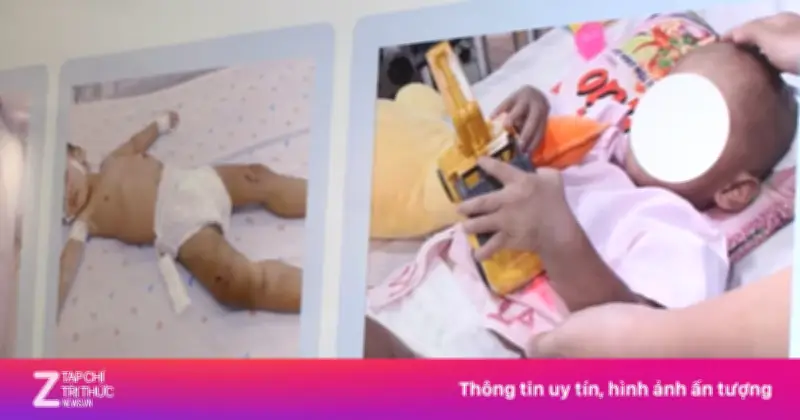 Bé trai 2 tuổi bị bạo hành vẫn khóc gọi mẹ mỗi đêm trong vô thức