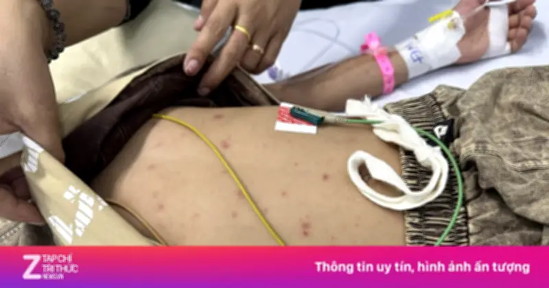 Bé trai 7 tuổi ở TP.HCM nguy kịch vì nhiễm não mô cầu sau hai ngày sốt