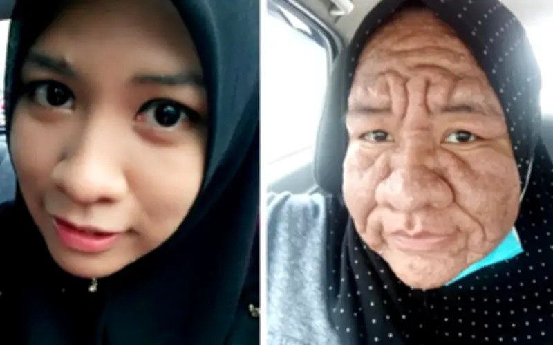 Cô gái 28 tuổi bỗng già như bà lão sau khi mang thai