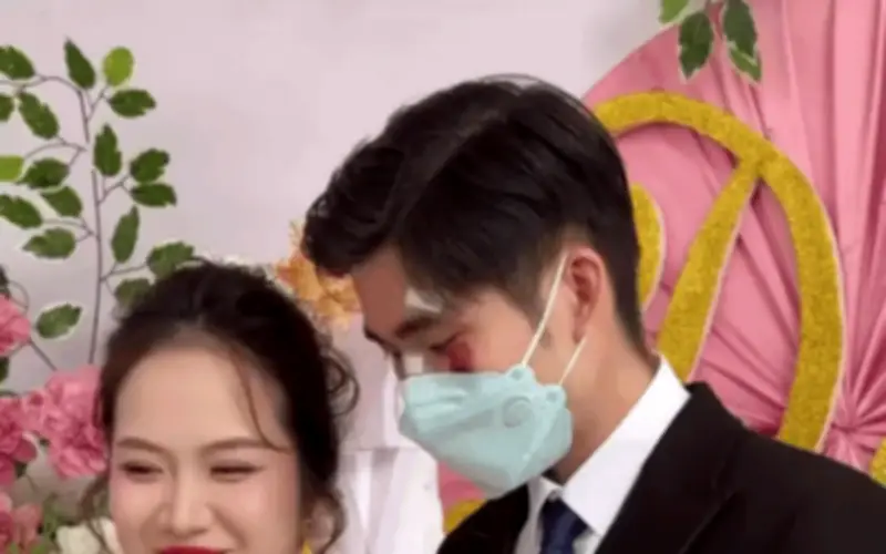 Chú rể đeo khẩu trang che mặt đầy vết thương trong ngày cưới vì tai nạn trước giờ lễ