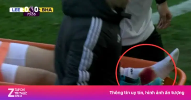 Chấn thương ghê rợn của Anton Stach khiến tuyển Đức lo lắng trước World Cup 2026