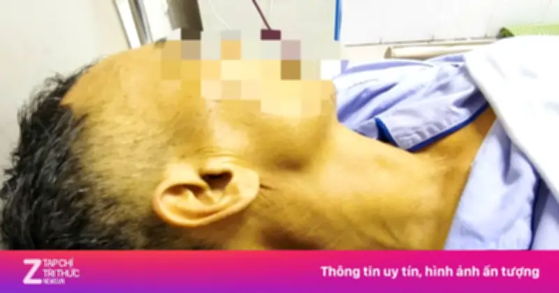 Gan tổn thương nặng vì thói quen uống rượu và dùng thuốc Nam không rõ nguồn gốc