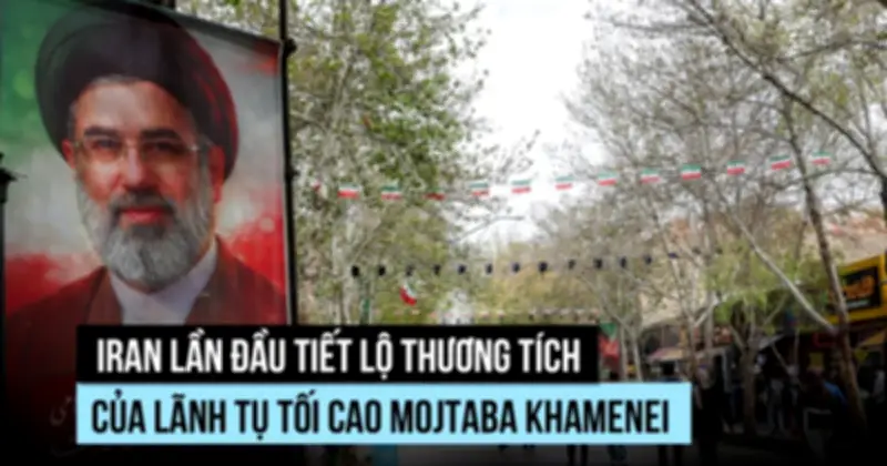 Iran hé lộ thương tích của lãnh tụ tối cao Khamenei trong trận không kích của Mỹ-Israel