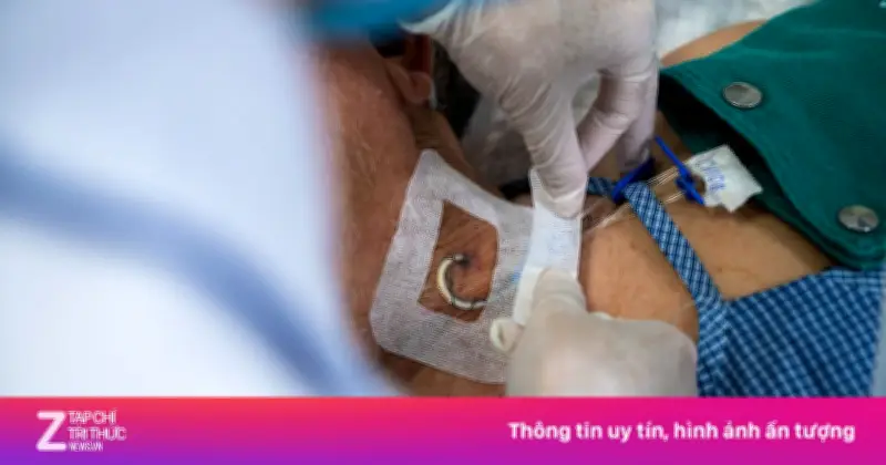 Loạt thói quen đẩy người trẻ đến đột quỵ xuất huyết não